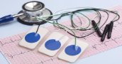 Curso de Técnico en Electrocardiograma, Holter y Ergometria